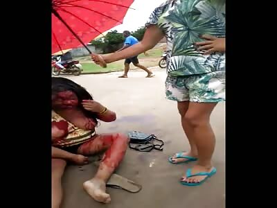 woman suffers serious accident in Grajaú