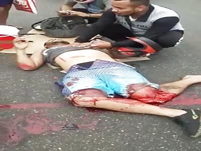 Victim with serious leg injury.