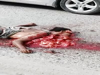 Cyclist crushed in street