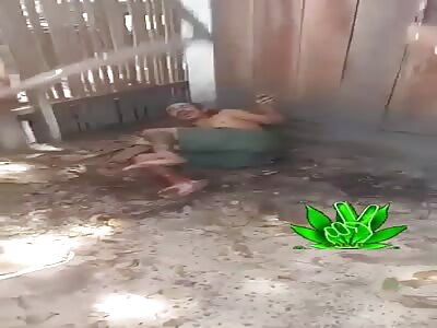 Thief had his ankles broken with sticks.