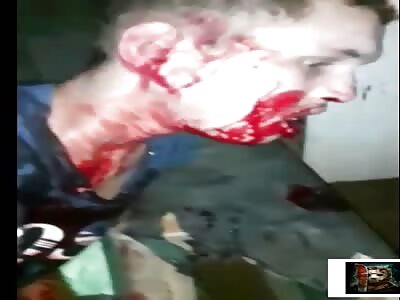 Man shot in the mouth was rescued