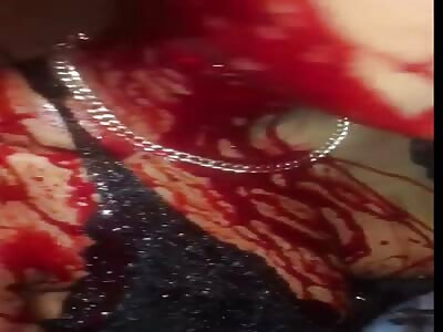 Man Attacks His Ex Girlfriend with Machete