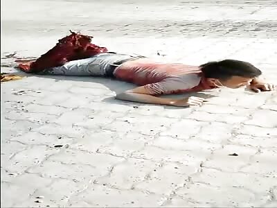 Extreme Pain, Legs Crushed by Tactor