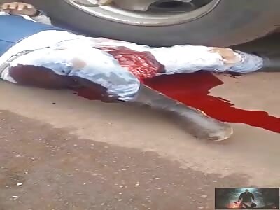 Biker and his crushed leg screams in pain