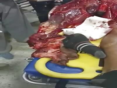 Fucking hell, man with his half skinned body