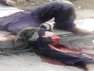 Man has leg severed in accident