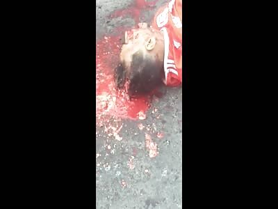 Man has broken head after being shot in slum in Vitória, Brazil