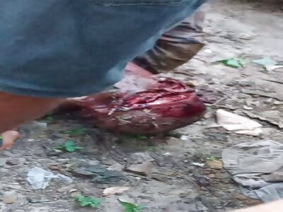 Killed when attacked with machete