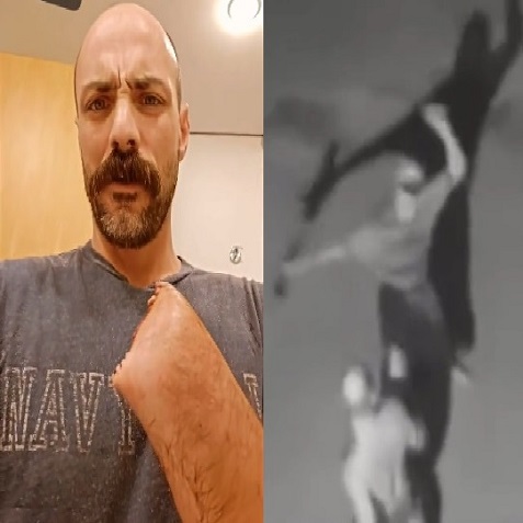 Man's Hand Cut Off In Horrific Machete Attack 