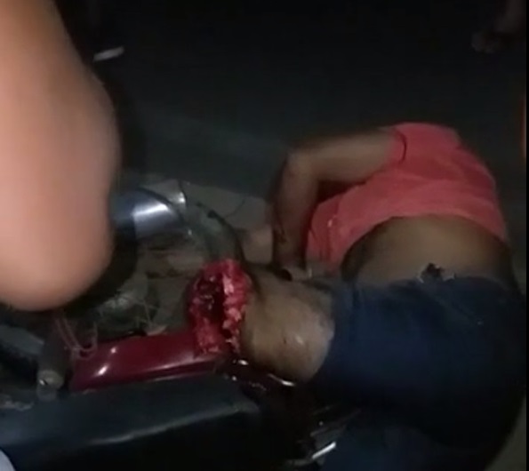 Biker loses his leg while riding at high speed