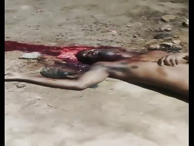 Man found with his cephalic mass exploded