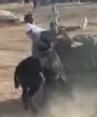 Arterial vein was punctured