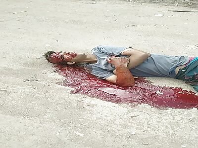 Man is dying from gunshot to the forehead