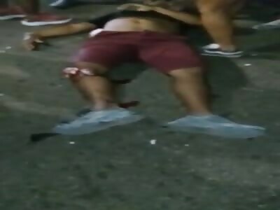 terrible knee injury