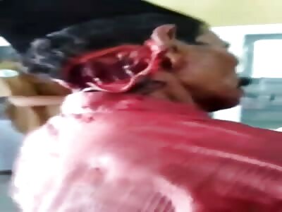 Horrible machete blow to man with hat