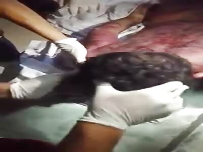 Sirius was cruelly tortured to death