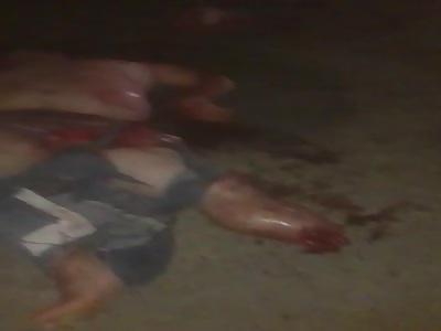 Obese man dismembered in accident