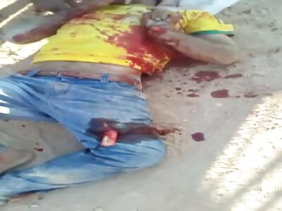 oh my god man with a broken bone