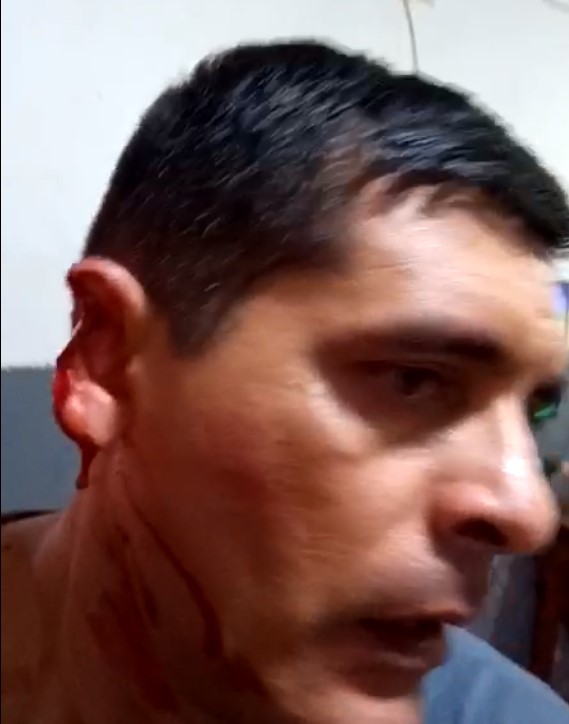 policeman has part of his ear bitten off