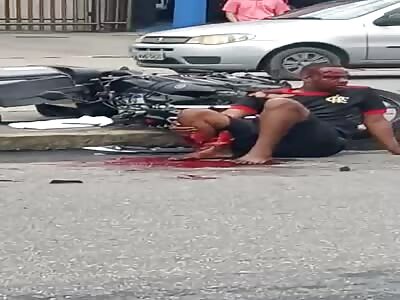 Poor biker had his leg torn apart