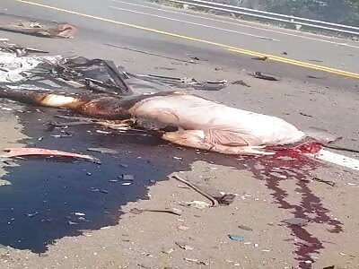 Burning accident victim