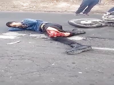 OMG, lacerated biker leg