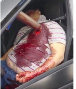 Doctor Says You Need Less Iron In Your Diet