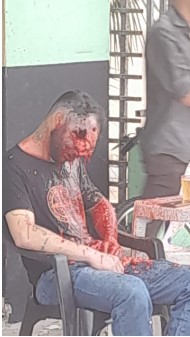 Not the Ideal Way to Relax In a Bar