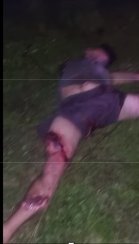 Man was dismembered on a dark road