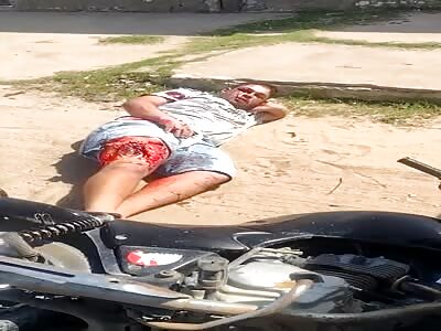 man has peeling skin