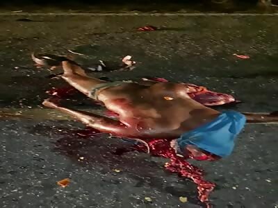 Horrible, man turned pizza in accident