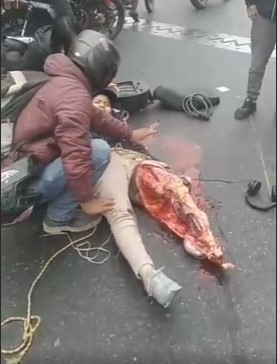 Poor girl in helmet, had her leg torn apart in an accident