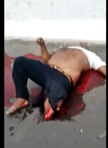 Poor sir belly has his leg severed