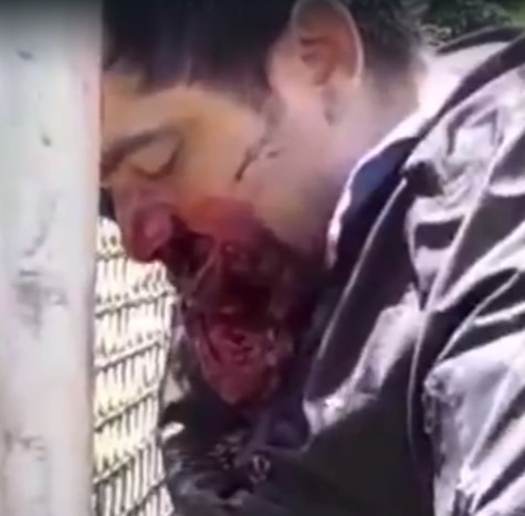 Man got faded in accident