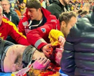 Soccer Flare Hits a Rival Fan in the Mouth (Full Video)