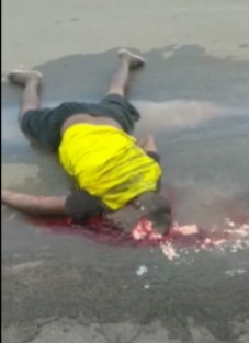 Man turned a dented head