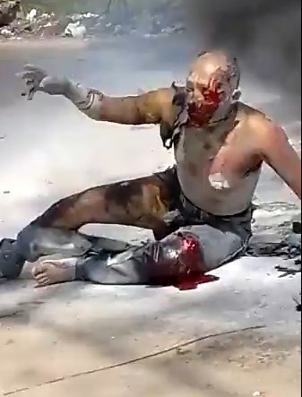 Biker Baked Alive In Colombia