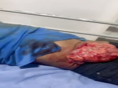 Aftermath of a bull attack in Colombia