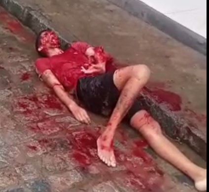 Man victim of machete attack