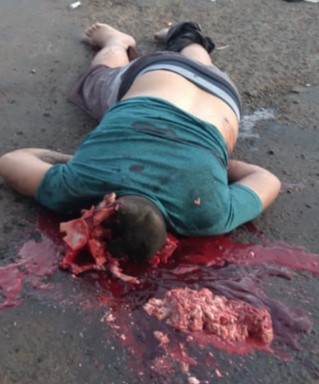 Man has a scattered brain with shotgun shot