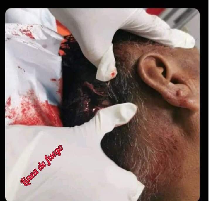 Protester executed by sniper in Peru