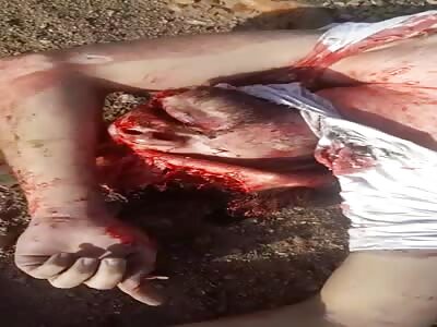 Man with his head crushed