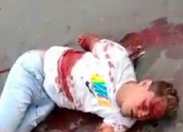 Motorcycle man loses his arm in Colombia