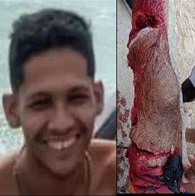 Swimmer Bleeds After Shark Attack