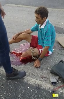 Victim had his leg torn off in accident