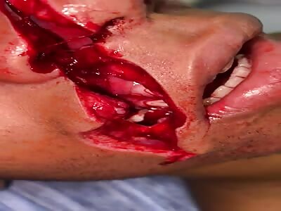 When Being Alive Is the Worse Option