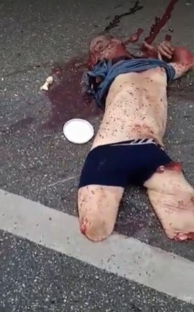 horrible man dismembered in accident