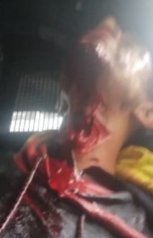 man tries to kill a woman and also tried to commit suicide