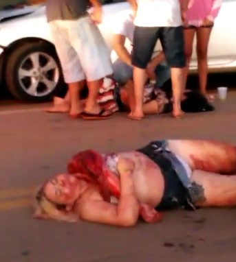 Victims in agony after being in an accident