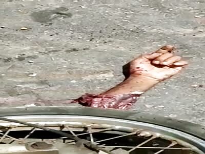 Old man have cut hand